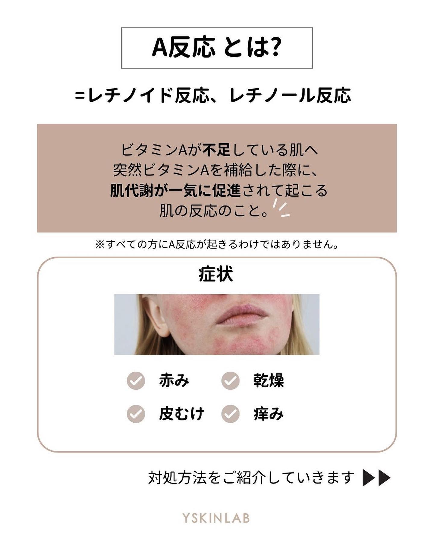 A反応とは？皮剥け・赤みの原因と期間・失敗しない対処法を徹底解説