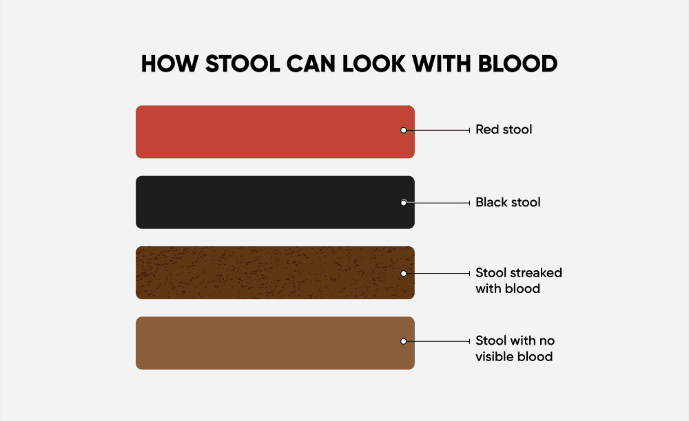What Is the Color of Blood in Colon Cancer