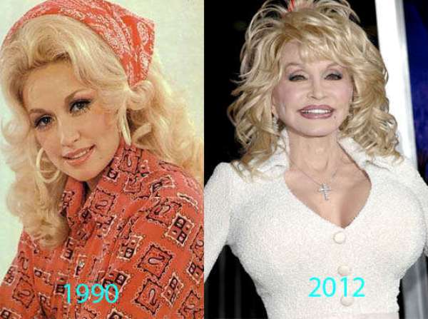 Not Silicone! Dolly's 1992 Confession About Her Breast Implants