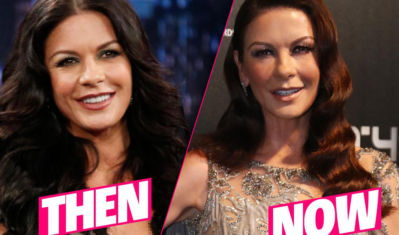 Has Catherine Zeta Jones Had Plastic Surgery