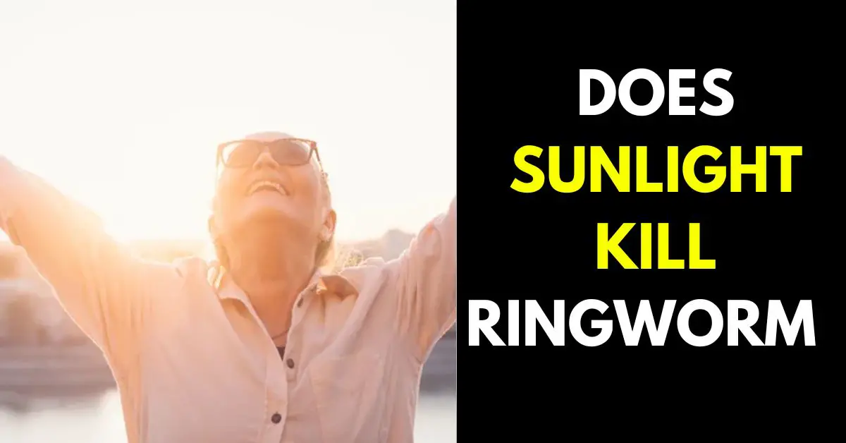 Is Sun Good for Ringworm
