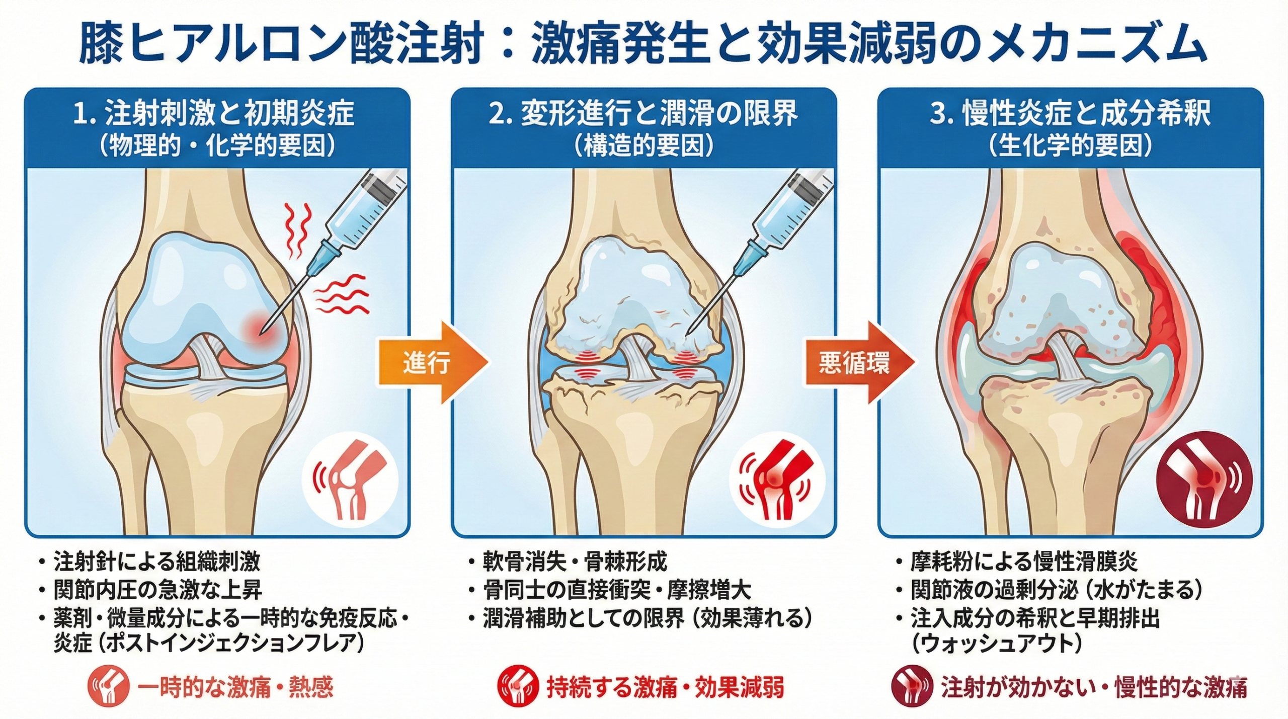 膝のヒアルロン酸注射は本当に効く？効果とやめ時の判断基準【2026年最新】