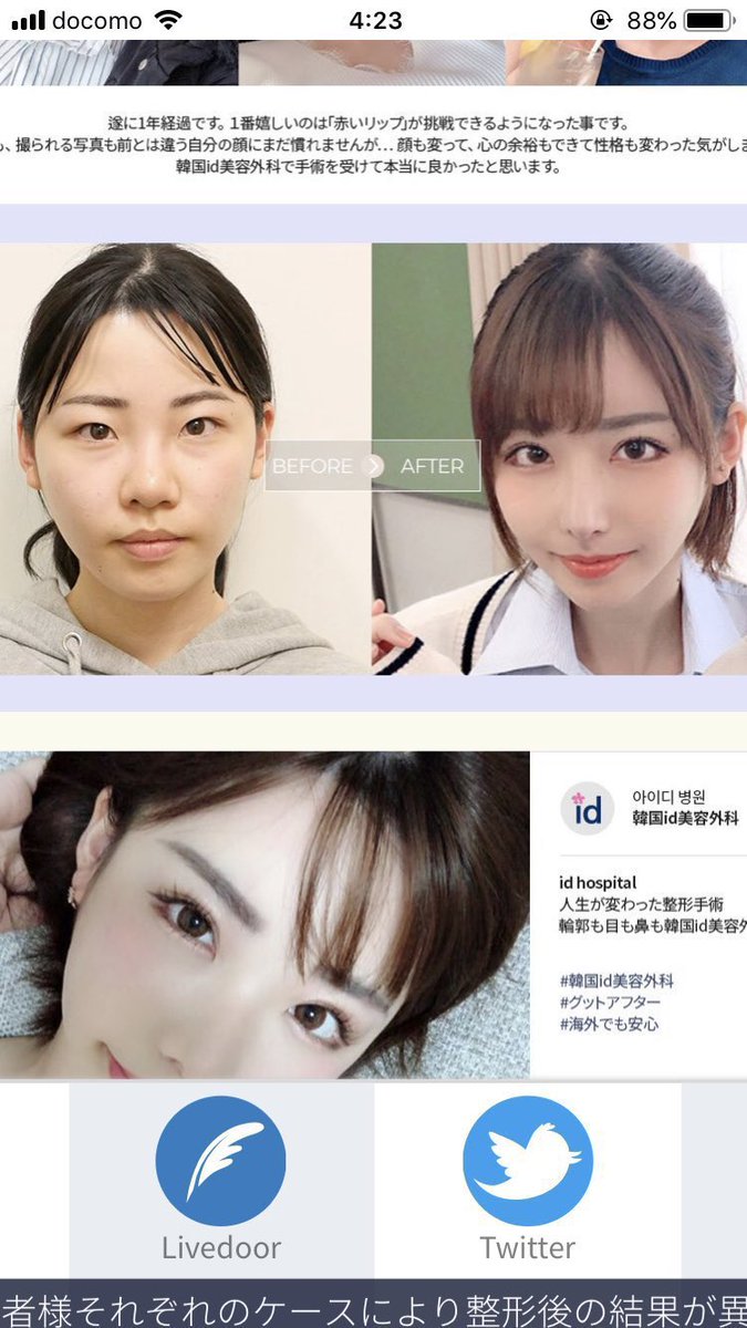 深田えいみの整形前と現在を徹底比較！昔の顔や韓国での費用と真相