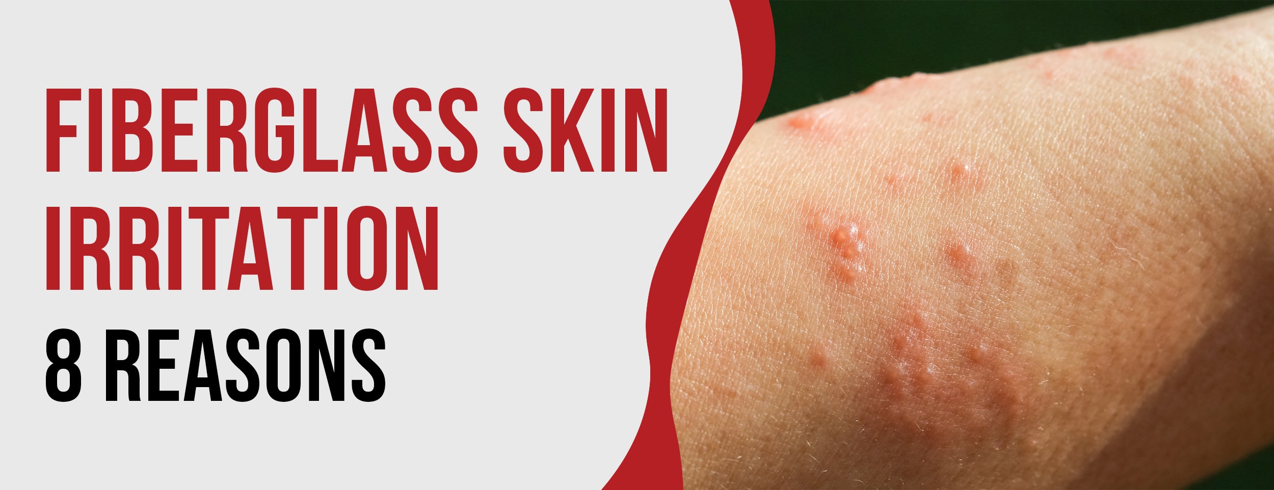 Fiberglass Rash Home Remedy