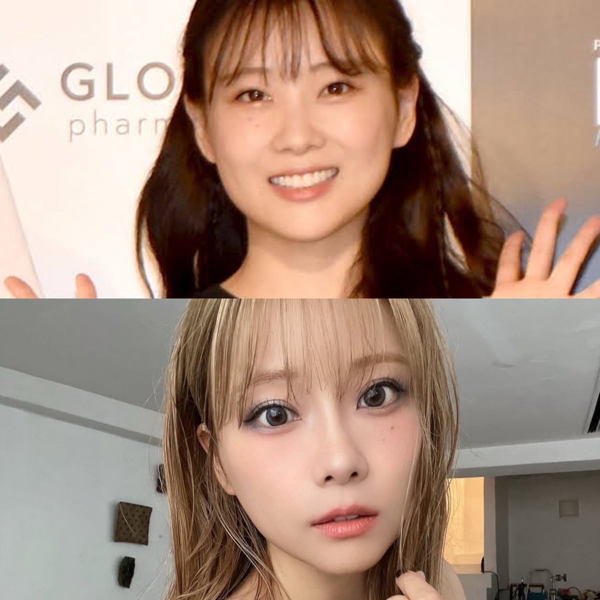 重盛さと美の顔が変わった？噂の真相と目元・鼻の変化を徹底検証