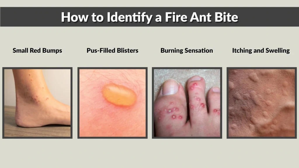How Does an Ant Bite