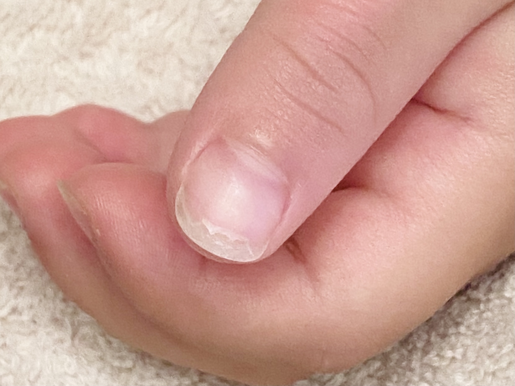 ボロボロ爪を即効修復！二枚爪の正しい対処法と爪切りNgの新常識