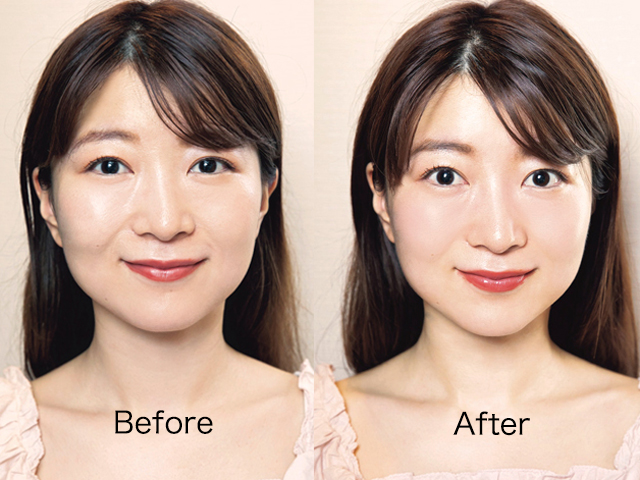頬骨が出てる美人はなぜ魅力的？立体小顔を叶える骨格美と垢抜け術の全貌