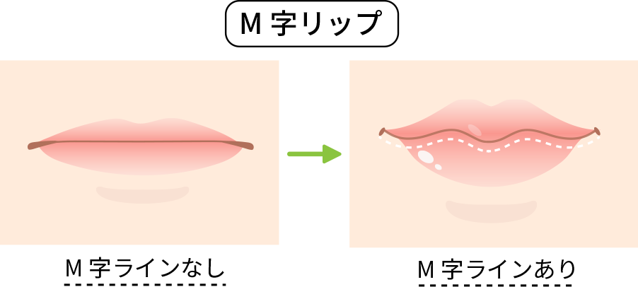 M字はげの髪型にツーブロックは似合う？失敗を防ぐ2026年の頼み方