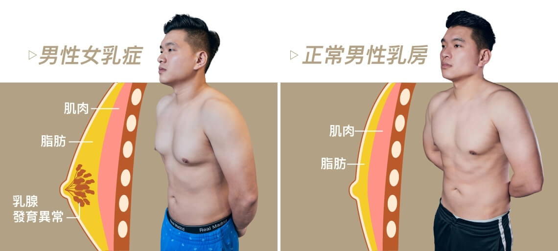 胸の脂肪を落とす最短ルート！筋トレの罠と2026年最新引き締め法