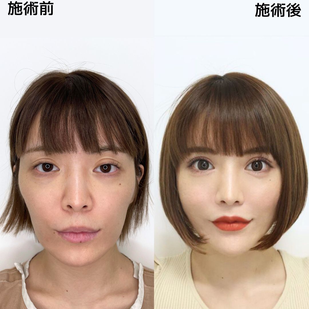 妹尾ユウカの現在と炎上の真相｜結婚や経歴・評判まで徹底解剖