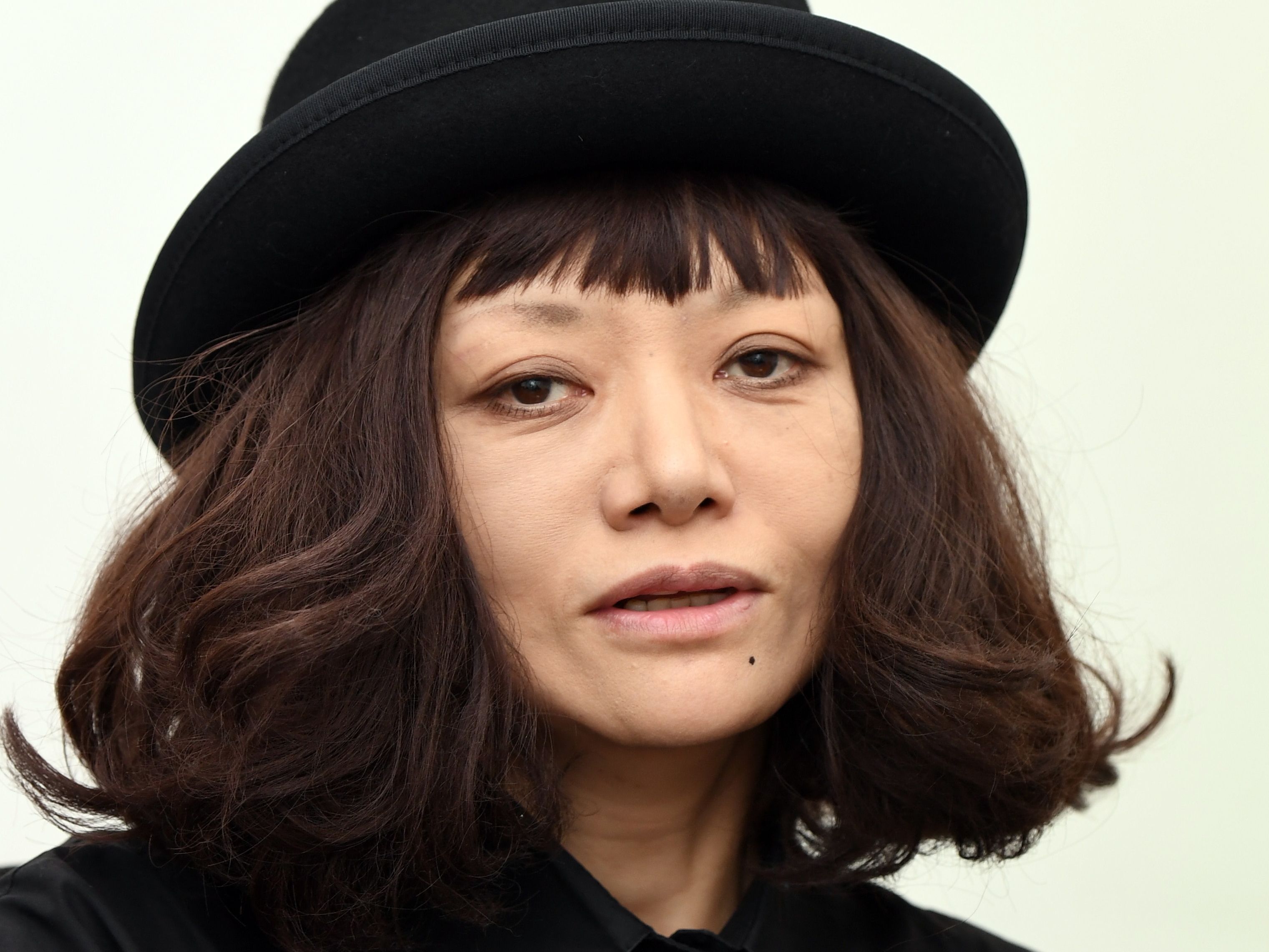 広田レオナ病気療養の真実！肺がん手術後の最新容態と舞台裏の覚悟