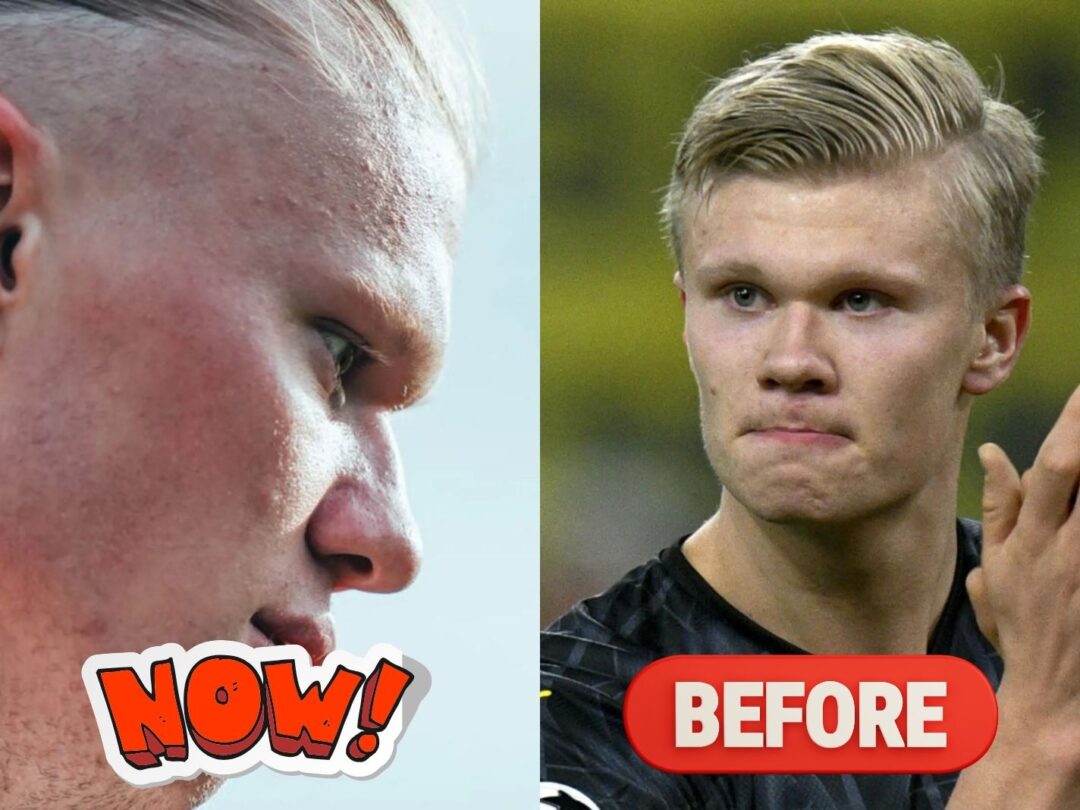 Did Erling Haaland Cut His Hair? His New Look Appears to Confirm It