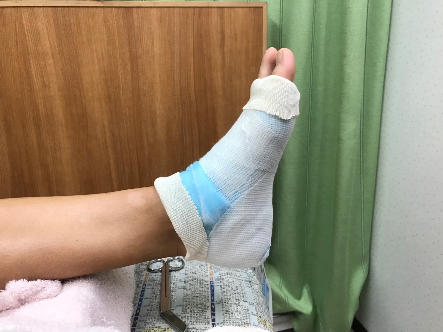 足の甲の疲労骨折は歩けるから大丈夫？初期症状と完治までの全真相