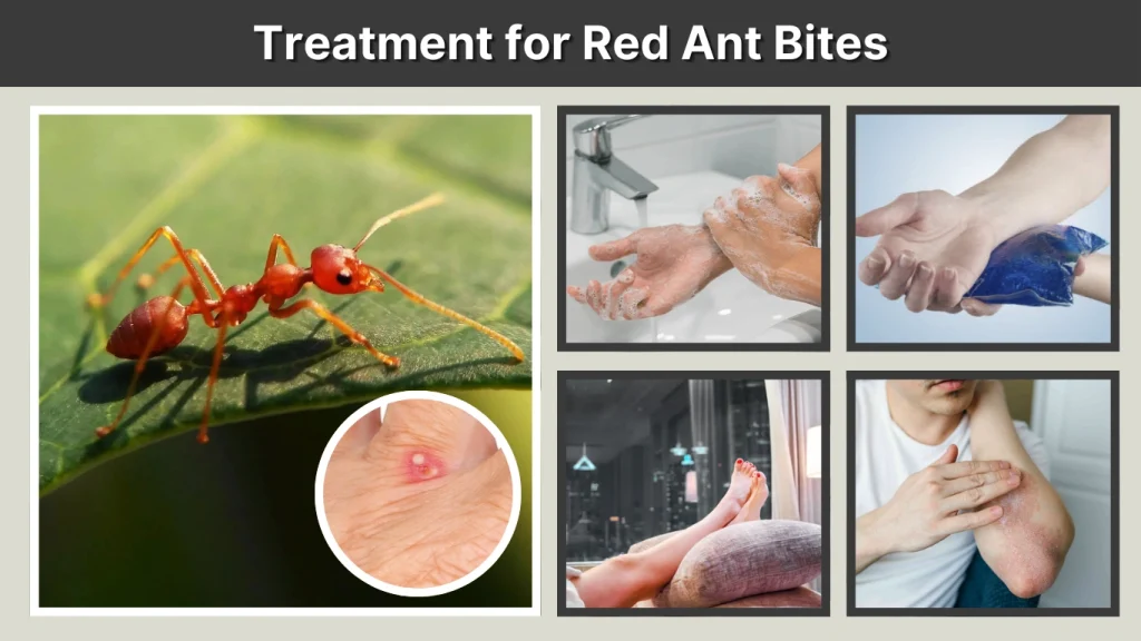 Ant Bites Cure
