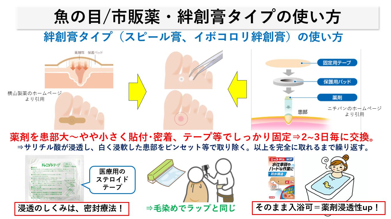 魚の目パッチの正しい使い方完全ガイド！芯の取り方と失敗しないコツ