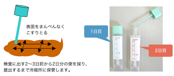 便潜血1回目陽性2回目陰性は平気？放置厳禁の真相と大腸がん確率