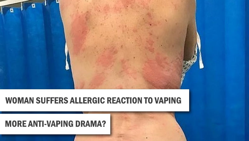 Can You Be Allergic to Vapes
