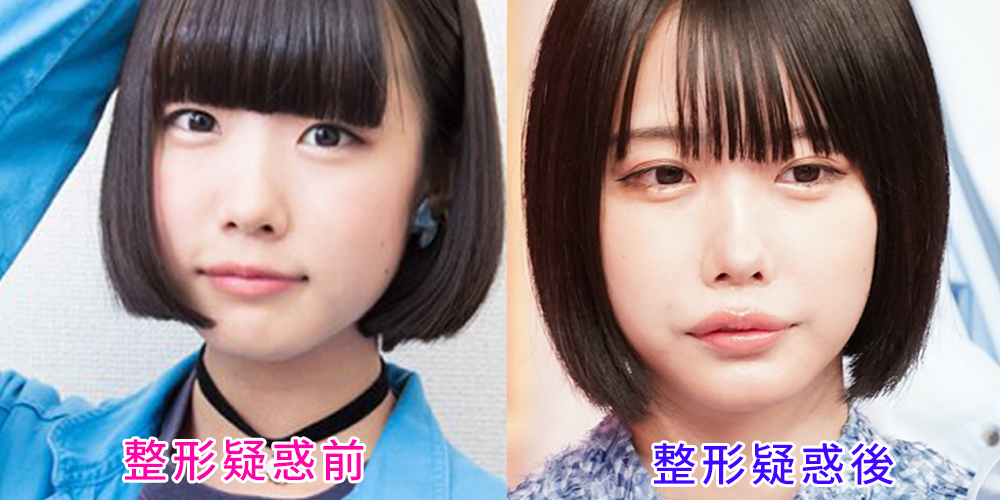 【2026最新】あのちゃんの過去画像と現在を徹底比較「整形前」噂の真相とビジュアル進化の足跡