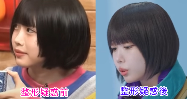 あのちゃん「整形疑惑」の真相に迫る——地下アイドル時代の秘蔵ショットから2026年最新の美容観まで徹底検証