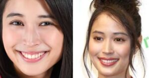 【徹底調査】 広瀬 アリス 顔 変わっ た 徹底解説＆真相まとめ #626