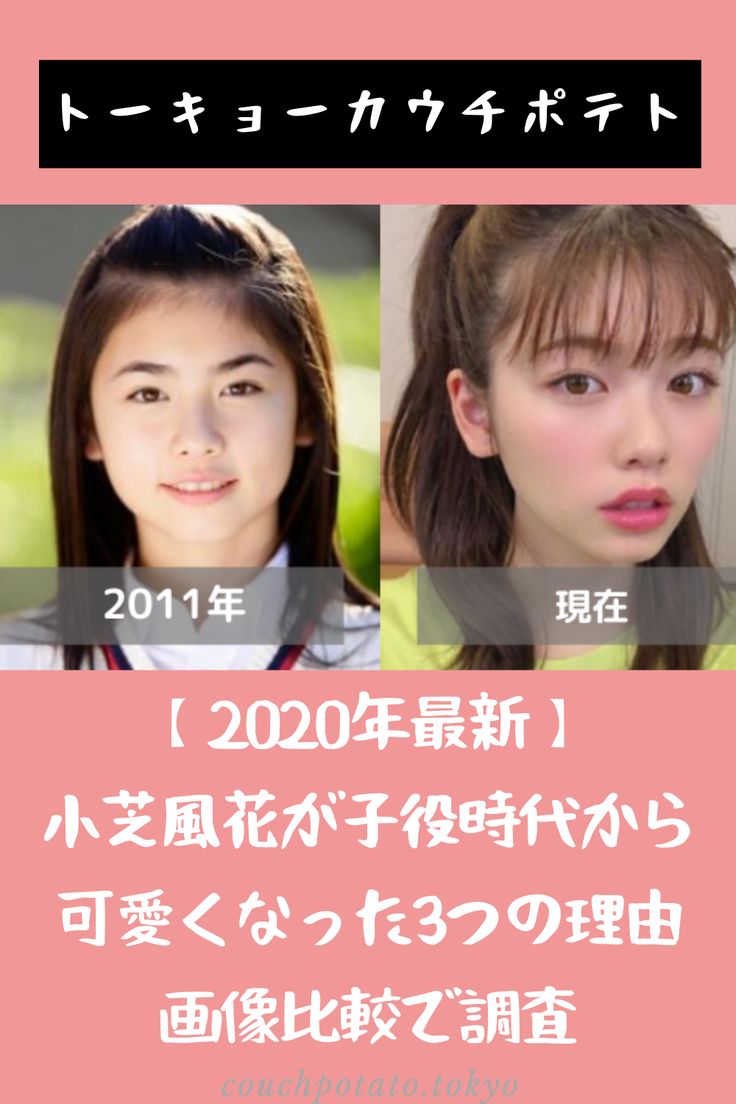 小芝風花はなぜブスと検索される？昔と現在の劇的変化と世間の本音