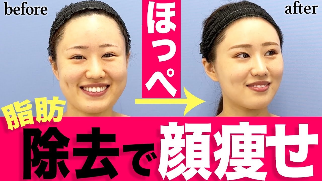口の中を噛む癖が治らない原因とは？病気のリスクと改善法を徹底解剖