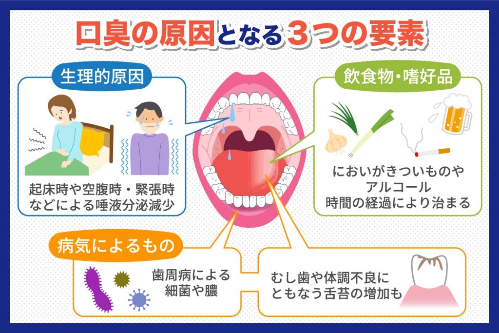 【2026最新】気づけない口臭の真相と原因別おすすめケア徹底比較