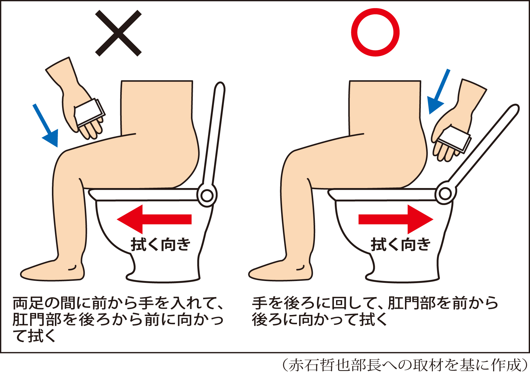【2026年最新】実は9割が誤解している？医師が警鐘を鳴らす「正しい肛門ケア」とお尻トラブルを防ぐ新常識
