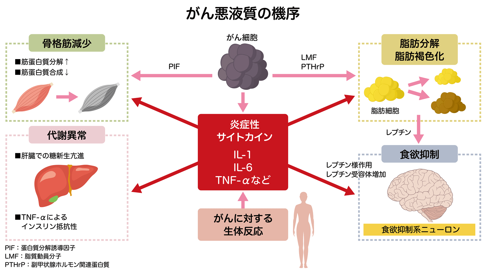 がん悪液質で急激に痩せる理由とは？2026年最新治療とケアの真相
