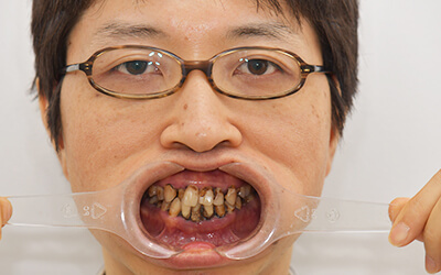 【熱愛】 歯 が ボロボロ 芸能人 2026年最新プロフィール #845