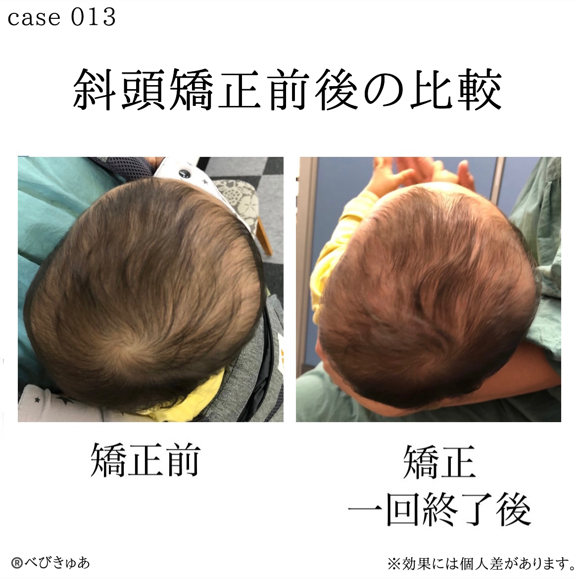 べびきゅあの評判と効果を徹底解剖！予約困難の真相と施術料金