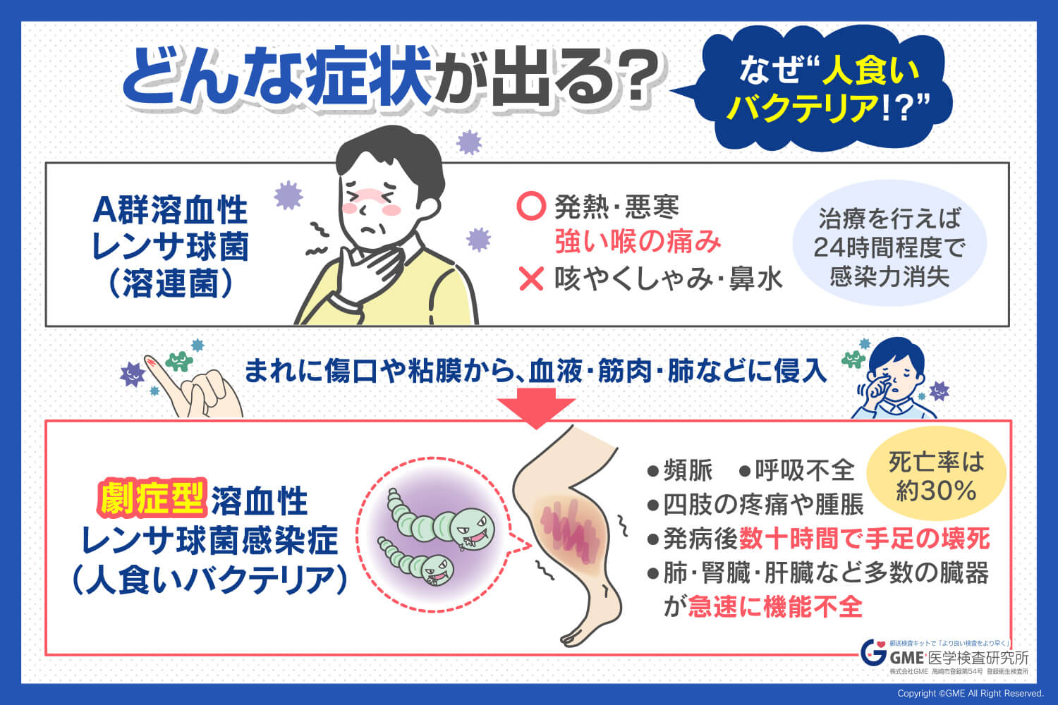【2026年最新警戒】「ただの風邪」が急変…致死率30%の「人食いバクテリア」見落としてはならない激痛のサインと命を守る緊急予防策