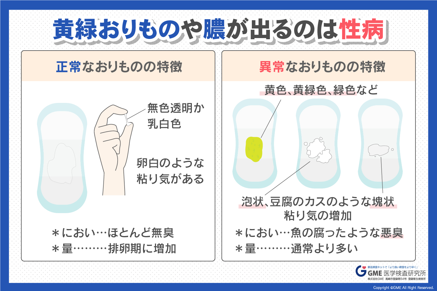 緑色のおりものは危険信号？原因と放置リスク・受診目安を徹底解説