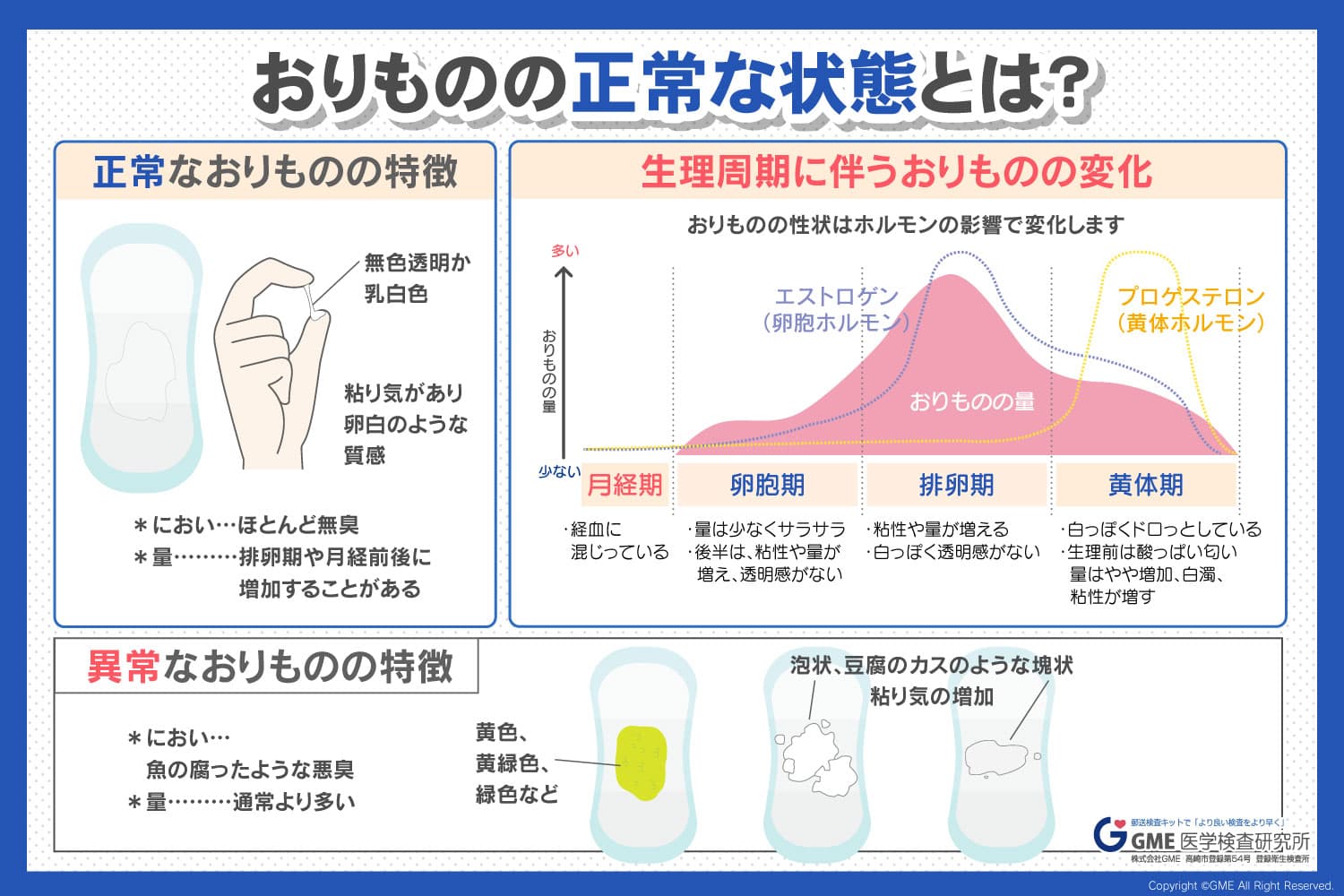 おりものが黄色く酸っぱいのはなぜ？病気のサインと受診基準を徹底検証
