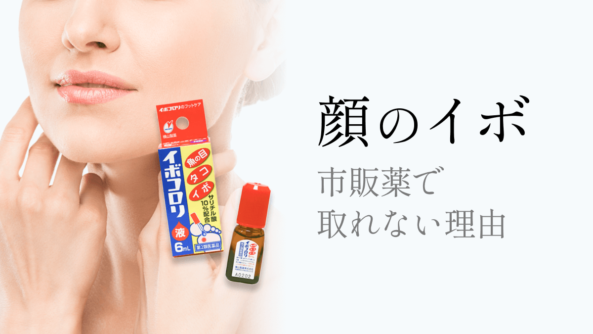 顔のイボ市販薬で取れる？イボコロリ厳禁の真相と2026年最新治療