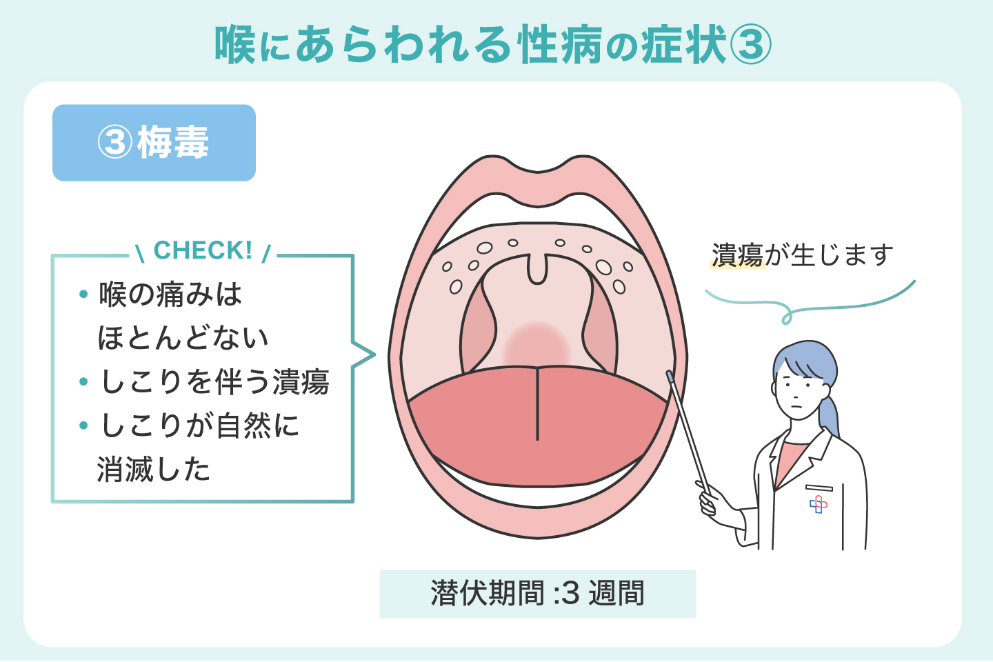 風邪薬が効かない喉の痛みは性病？咽頭クラミジア・淋菌の真相【2026年最新】