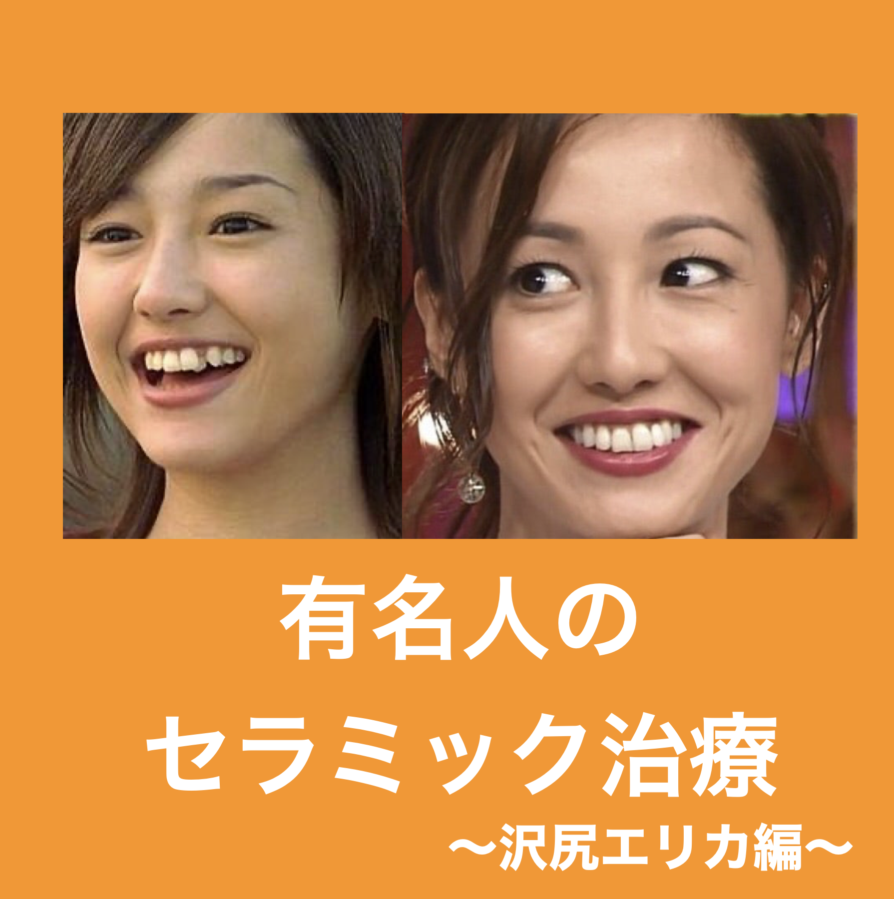 沢尻エリカの歯が長い理由は？八重歯から激変した口元の秘密を徹底検証