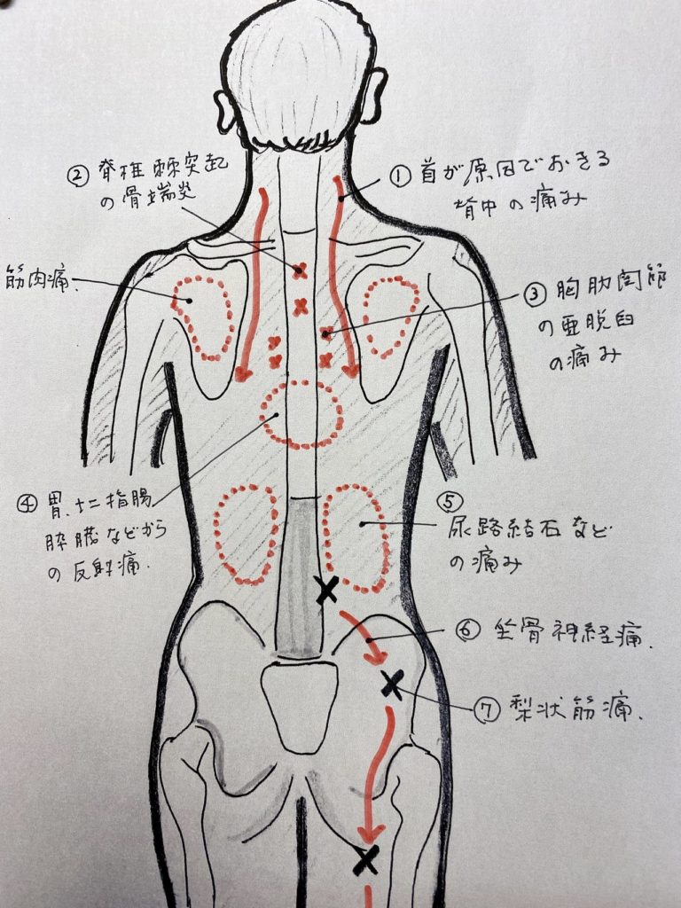 運動してないのに背中が筋肉痛？危険な病気の見分け方と即効解消法