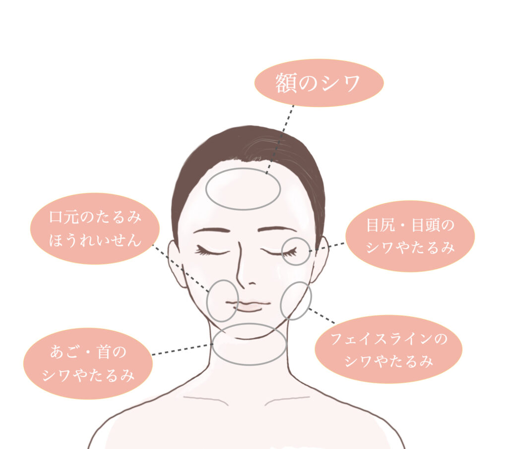 テノールとは？音域やバリトンとの違い・三大テノールの魅力まで徹底解剖