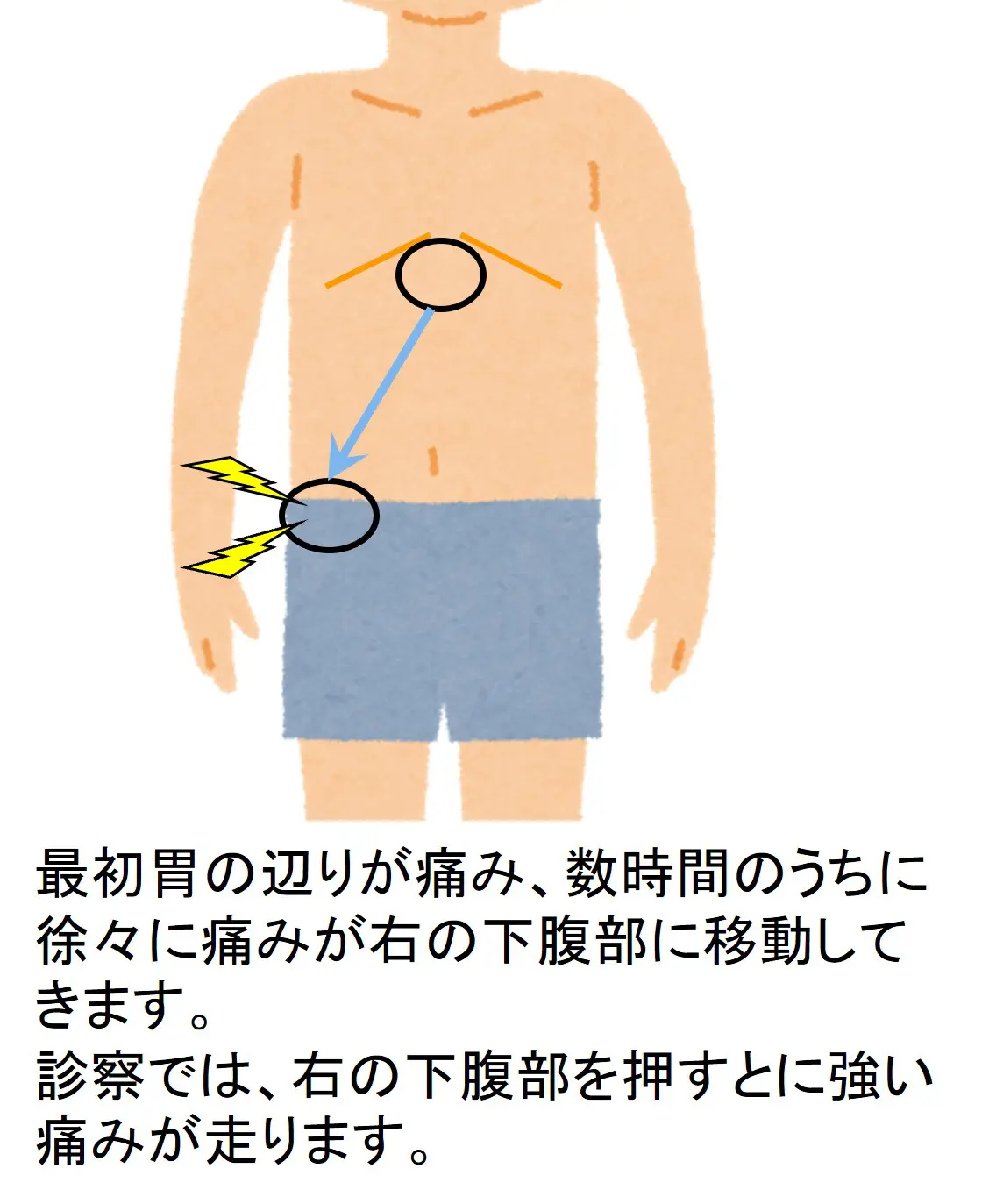 みぞおちの下が痛い原因と危険なサイン！胃炎や胆石・膵炎を見極める