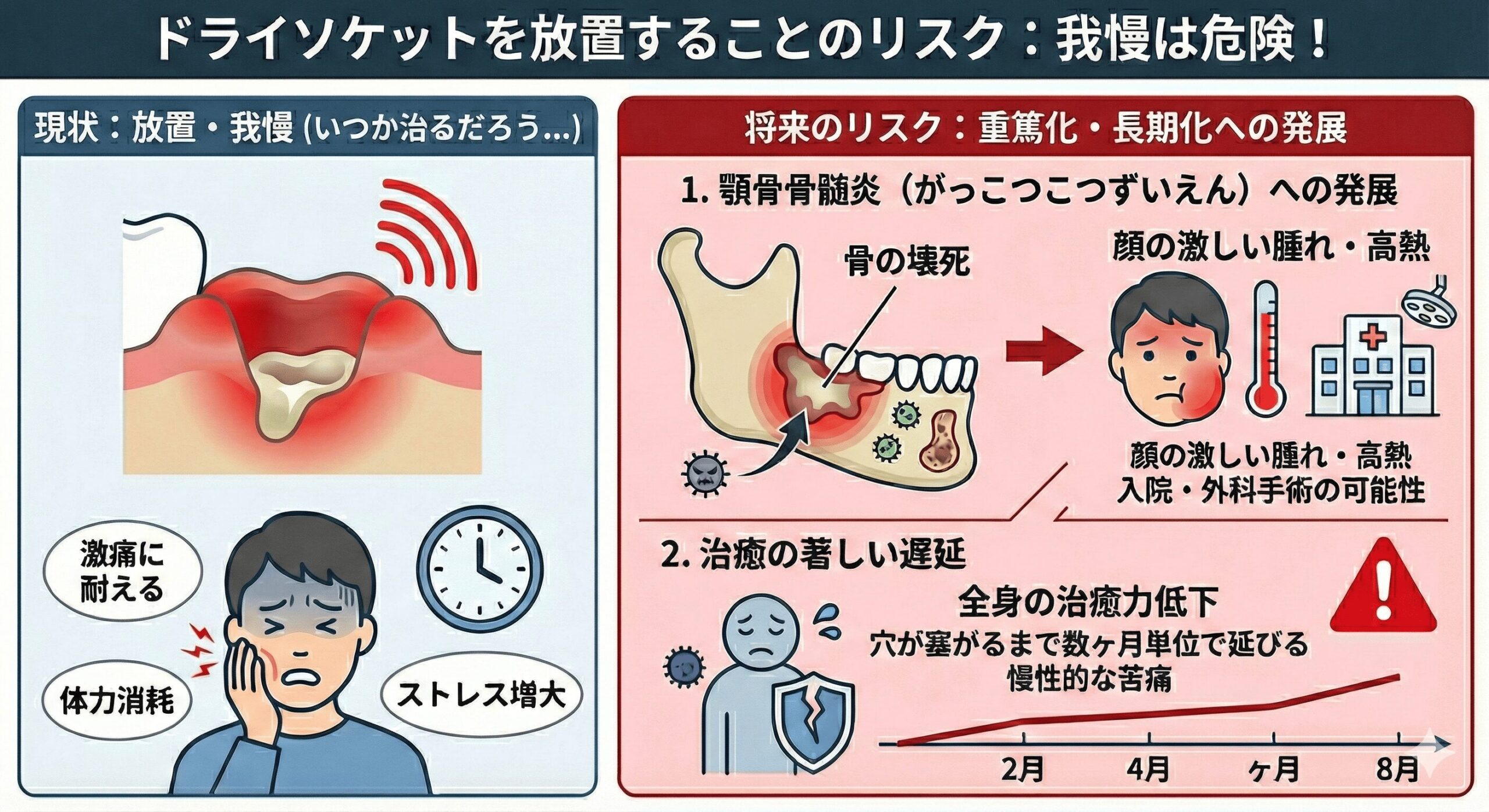 親知らず抜歯後の激痛は危険？ドライソケットの治療法と見分け方