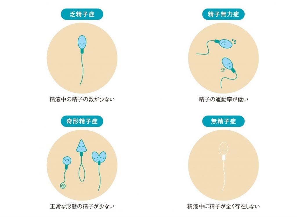 精液量が少ない原因とは？男性不妊の危険信号と2026年最新の受診目安