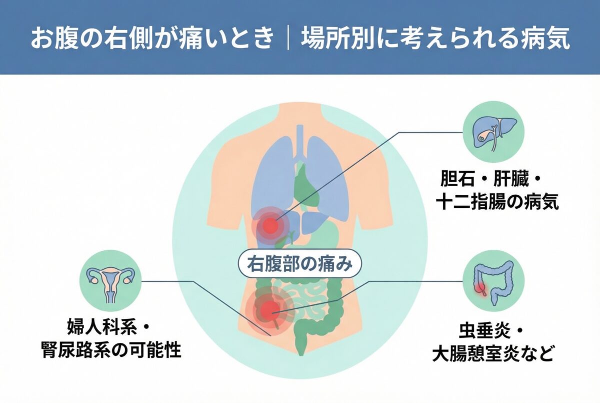 右のお腹が痛いのはなぜ？盲腸・胆石を疑う3つの危険サインと対処法