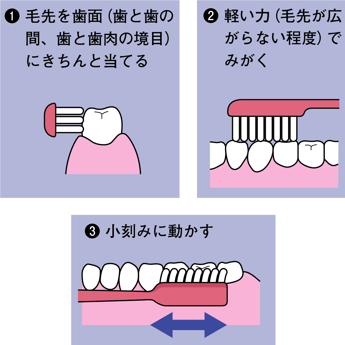 歯磨きのやりすぎが歯を削る？知覚過敏と歯茎の退縮を防ぐ真実