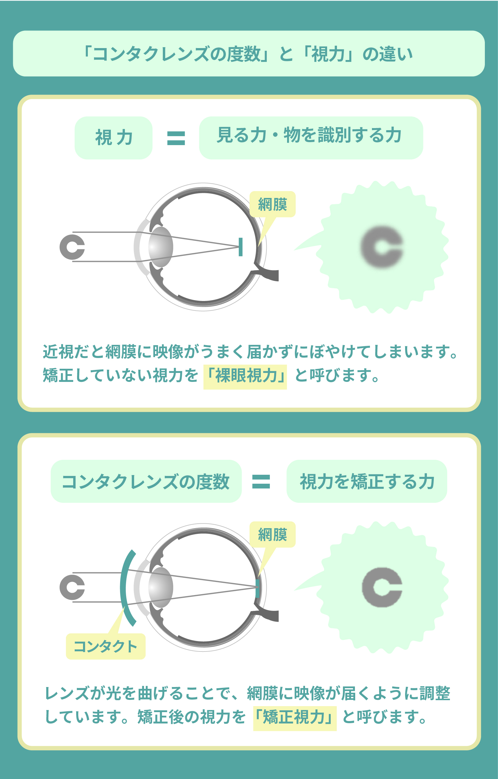 アイシティでコンタクトを買う前に知るべき真相と最安攻略法