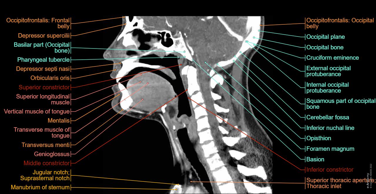 Does a Ct Scan of the Head Include the Neck