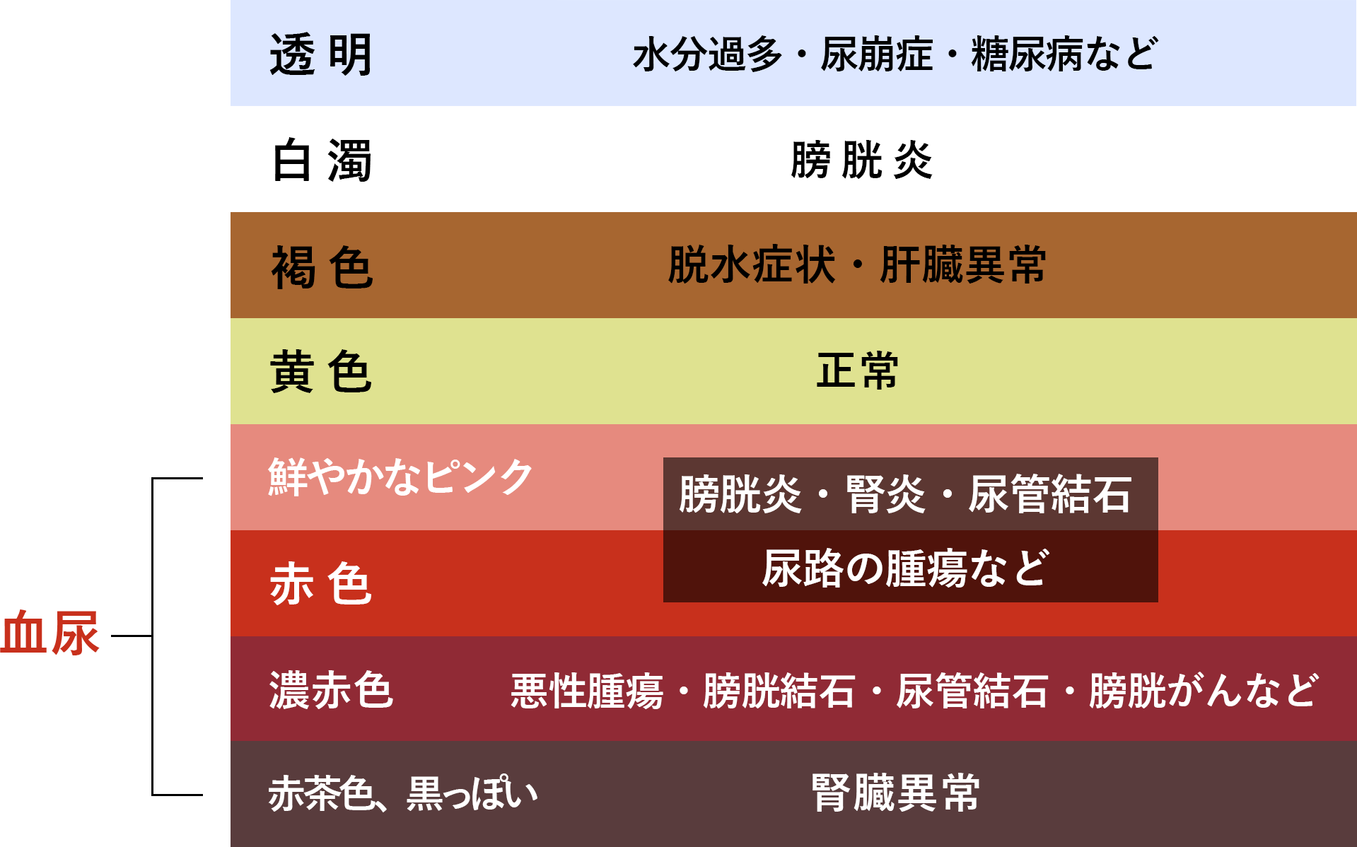 女性の痛みのない血尿は放置厳禁！膀胱がんの疑いと受診すべき科
