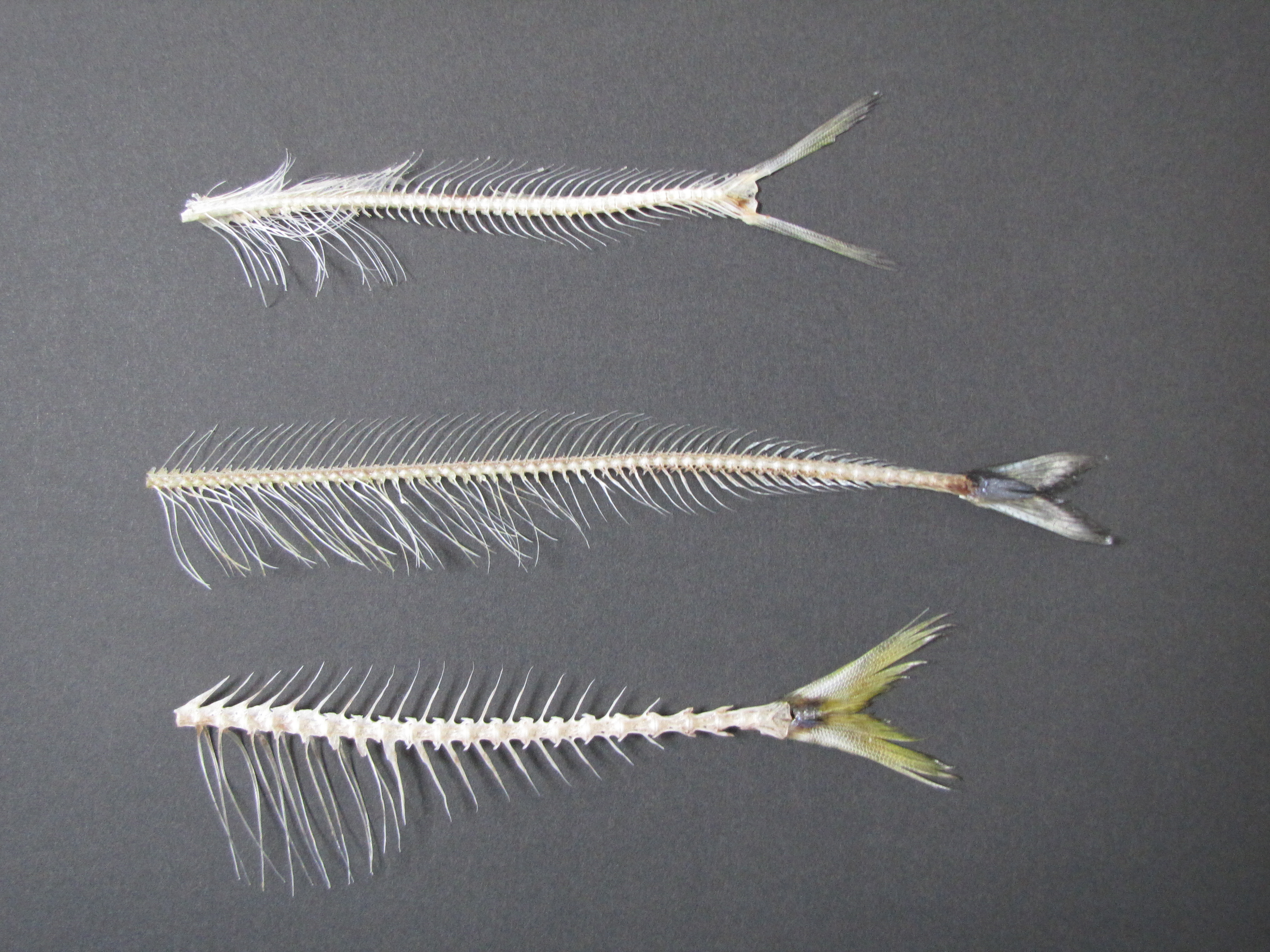 喉に魚の骨が刺さった時の対処法！ご飯丸呑みが危険な理由と受診目安