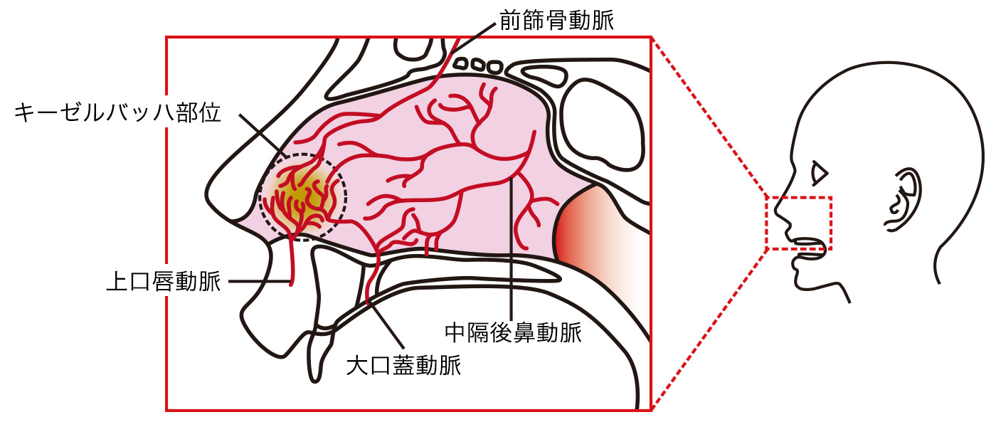 大人の急な鼻血は危険信号？高血圧や重病を見抜く原因と正しい止血法